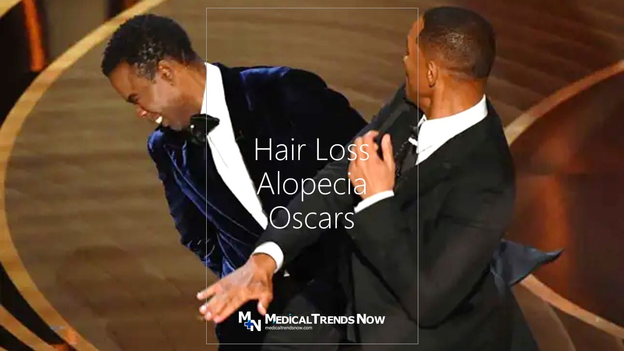 Jada Pinkett Smith hair loss, Alopecia medical condition, struggles of losing hair for females, Oscars 2022, The Academy Awards