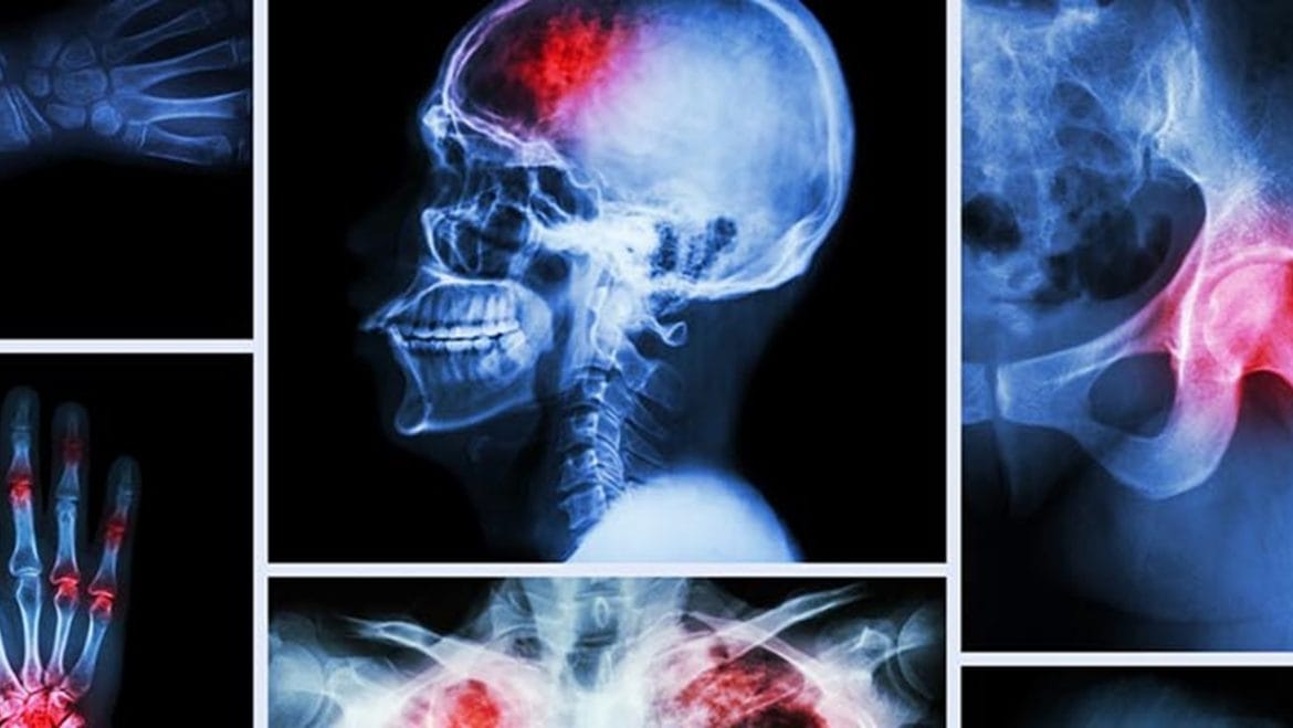 nuclear medicine, PET scan, Brain scans, Heart scans, Gallium scans, Bone scans, Renal scans, Thyroid scans