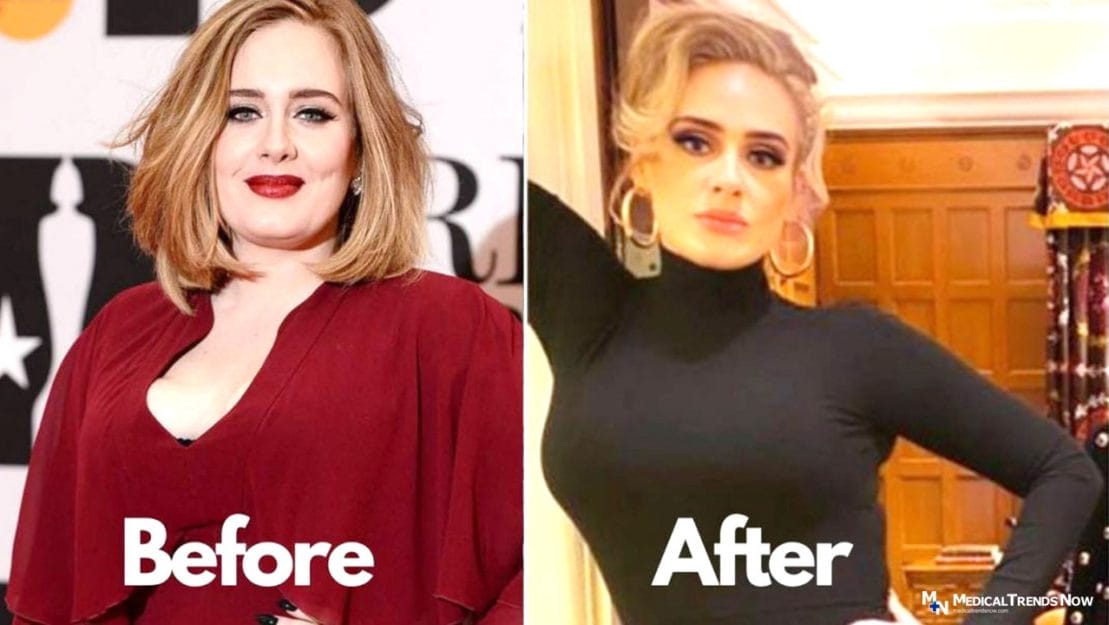 Adele weight loss photo. Before and After