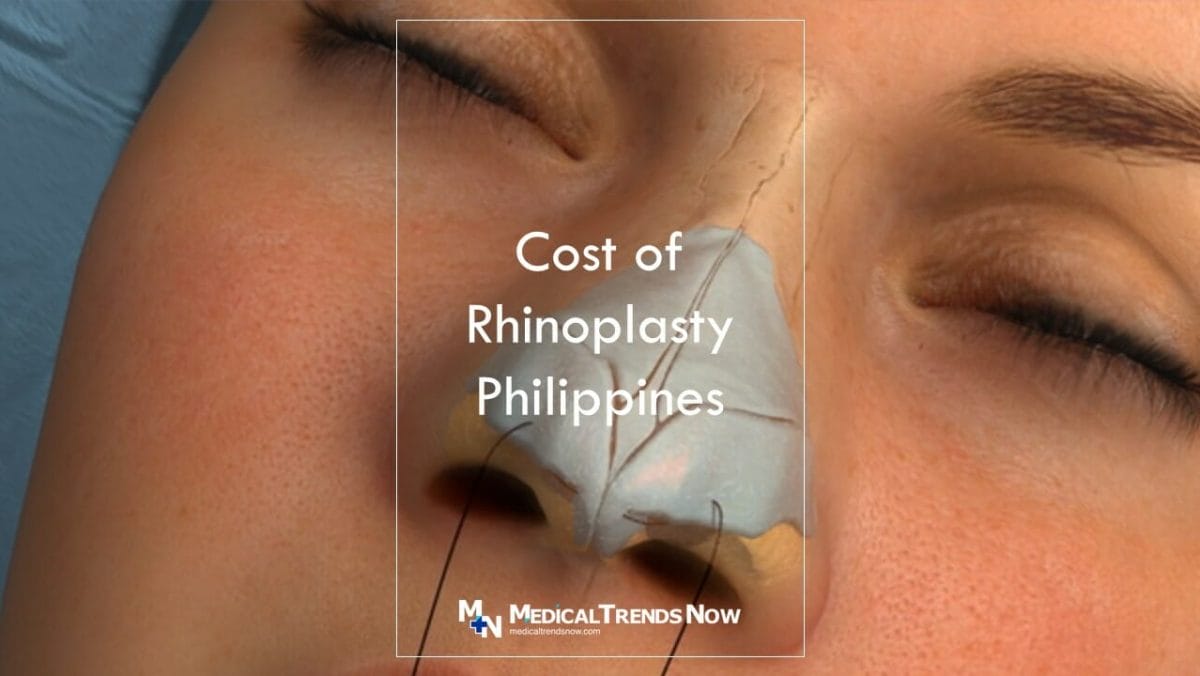 Which country is best for nose surgery?