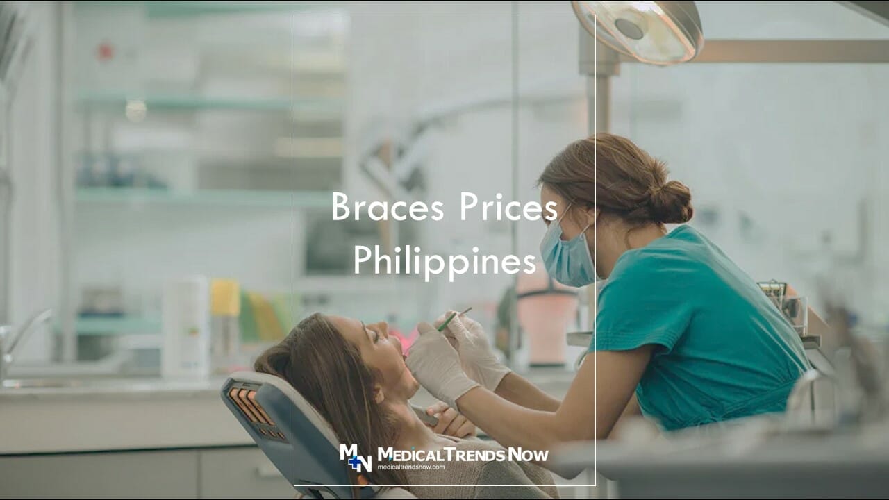 How much is clear braces in the Philippines? Can I change dentist for braces Philippines?