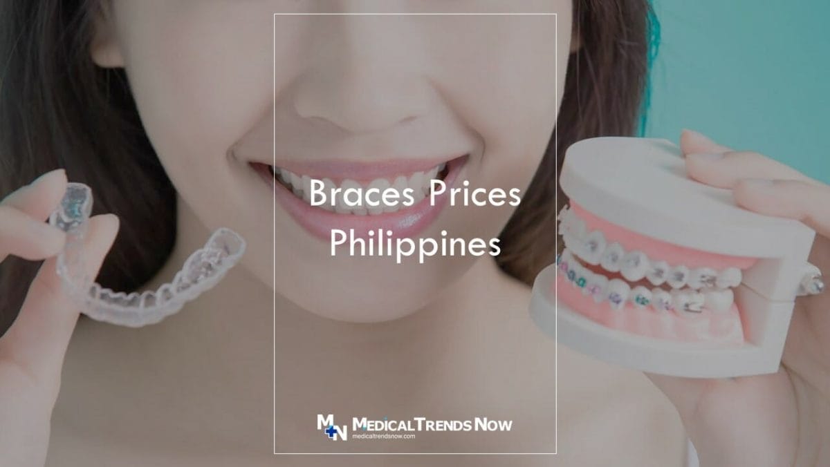 Why do braces cost so much? Is braces expensive in Philippines?