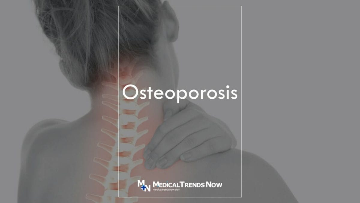 Osteoporosis among Filipinos