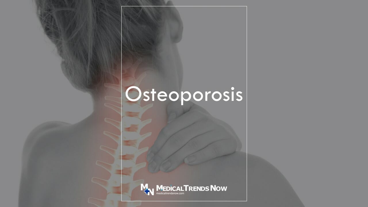 Osteoporosis among Filipinos