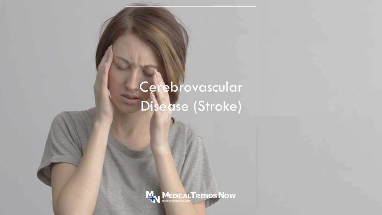 Cerebrovascular Disease (Stroke) among Filipinos