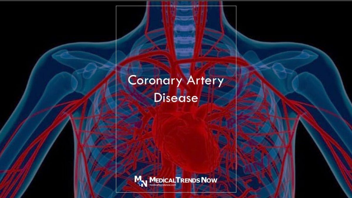 Coronary Artery Disease among Filipinos