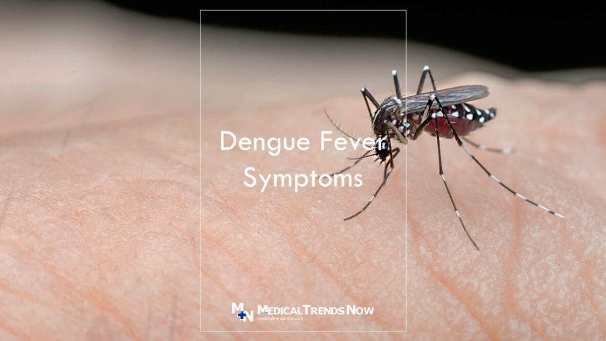 Is dengue fever serious in children?