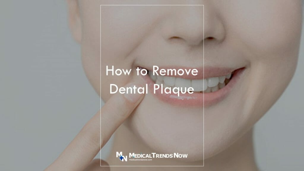 how-to-get-rid-of-plaque-on-your-teeth-fast-with-these-tips-medical