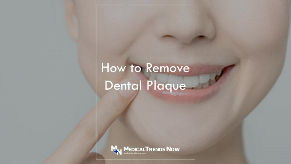 What's the difference between plaque and tartar?