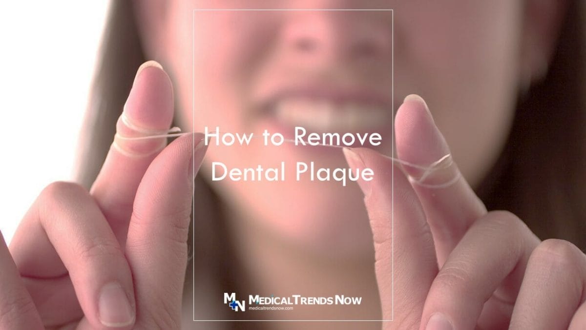 How do you remove hardened plaque?