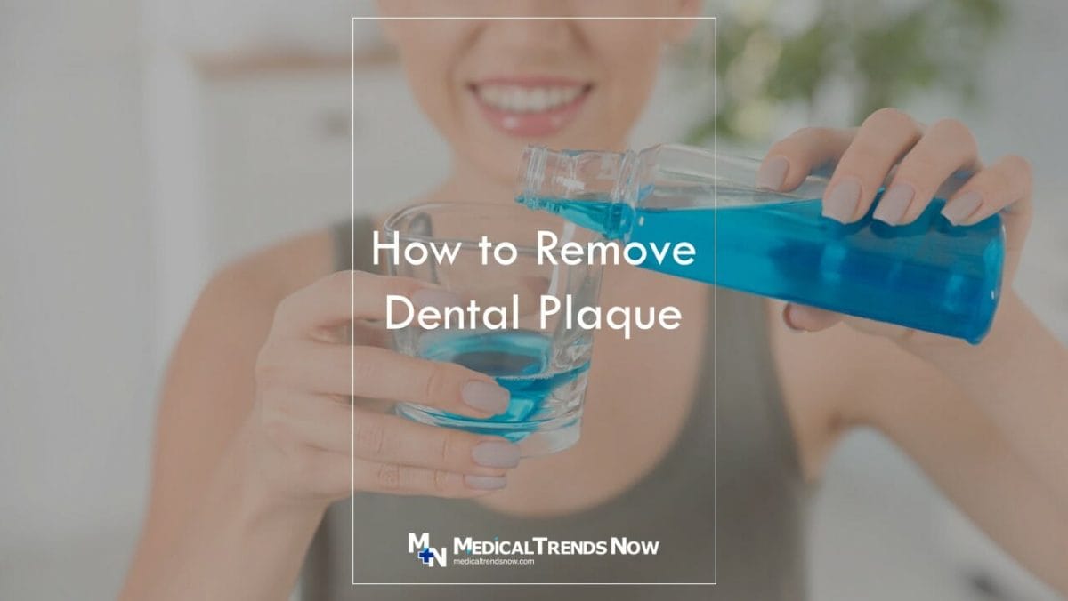 Can teeth plaque go away?