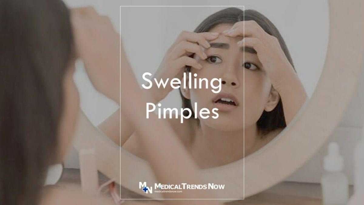 How do you shrink a pimple? Infected Pimple: Symptoms, Treatments, and Prevention