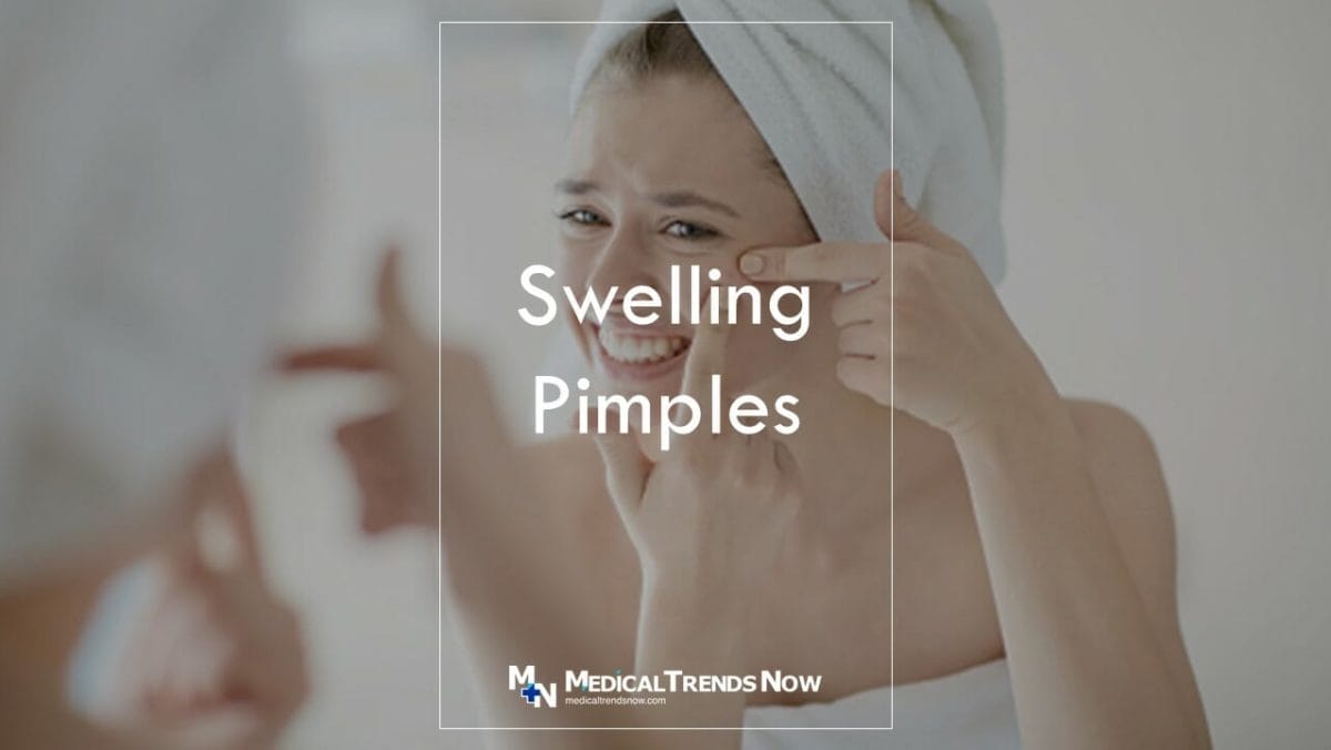 Why is my pimple so swollen?How to Shrink a Pimple Fast — Expert Tips 