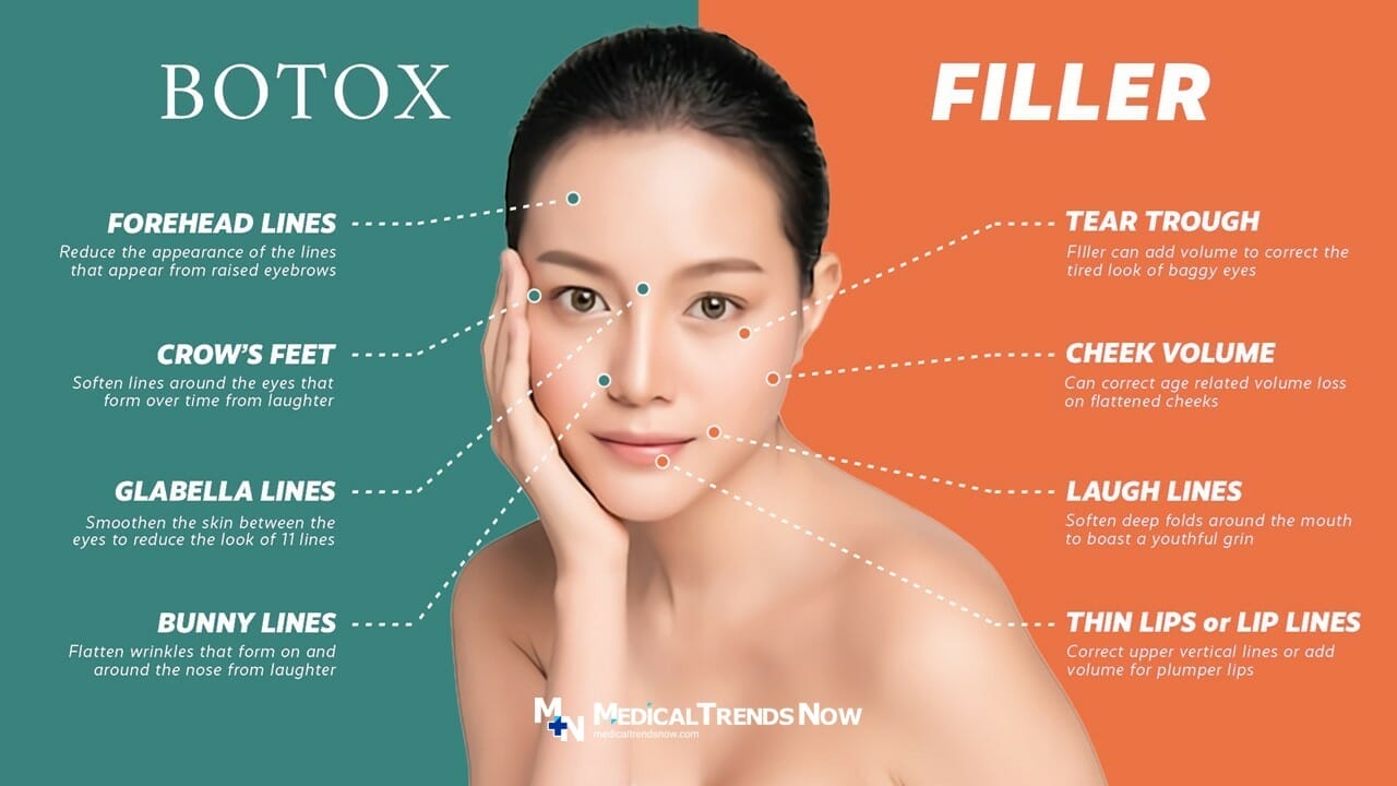 Botox vs. Dermal Fillers: The Right Injectable for Filipino Skin ...