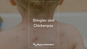 What are the 1st signs of shingles? Shingles - Symptoms and causes 