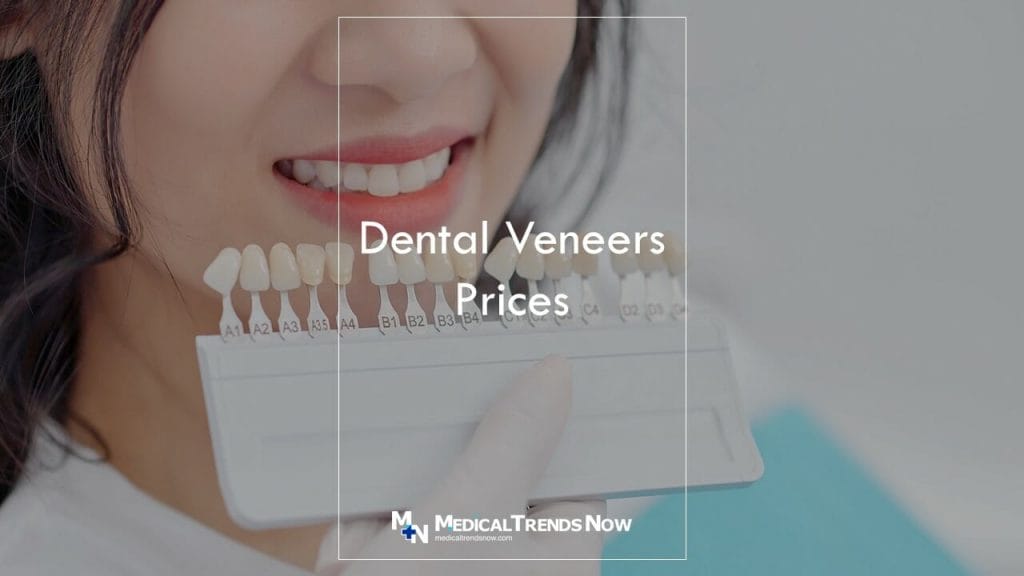 How long do veneers last on teeth? How Long Do Veneers Last on Front Teeth?