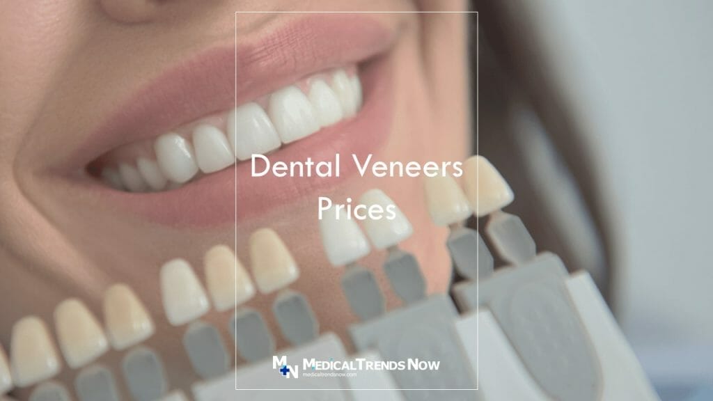 Dental Veneers in the Philippines The Price of a Filipino Smile 2023 Medical Trends Now