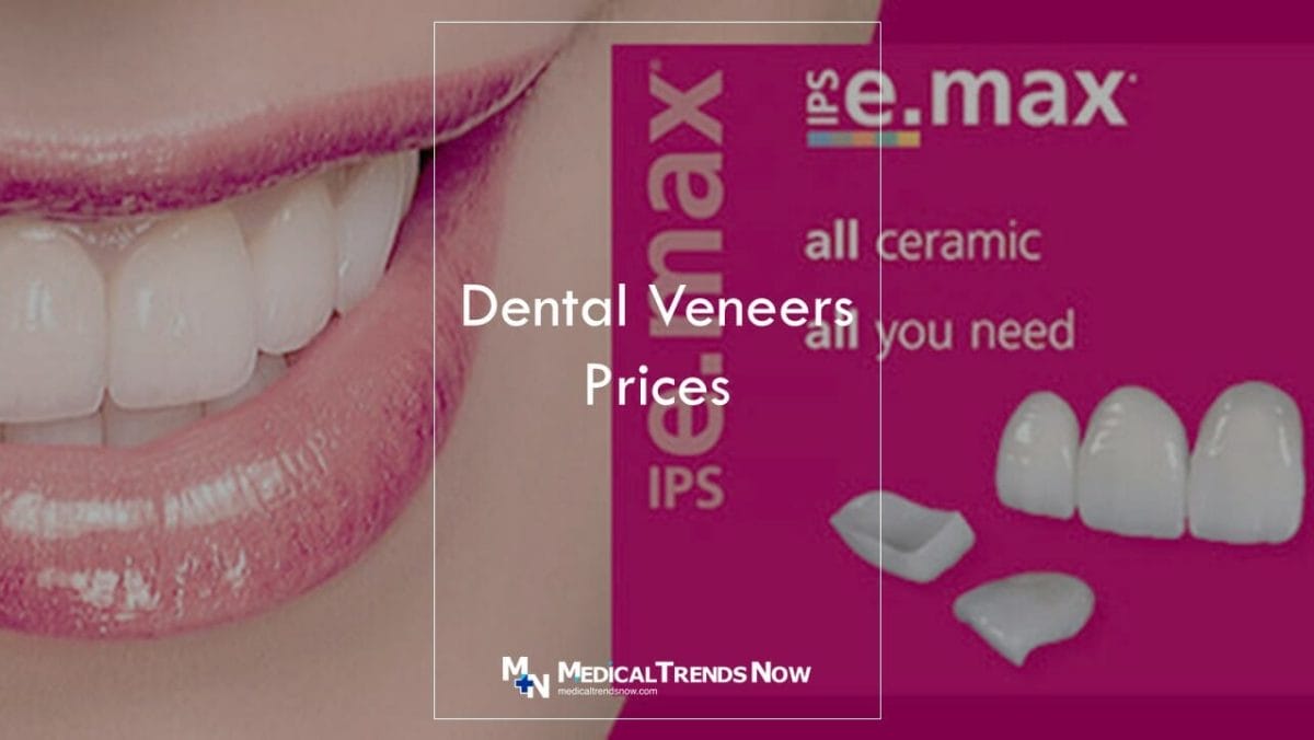 Where can I buy porcelain veneers in the Philippines?