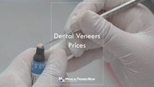 Why Have Dental Veneers in the Philippines?