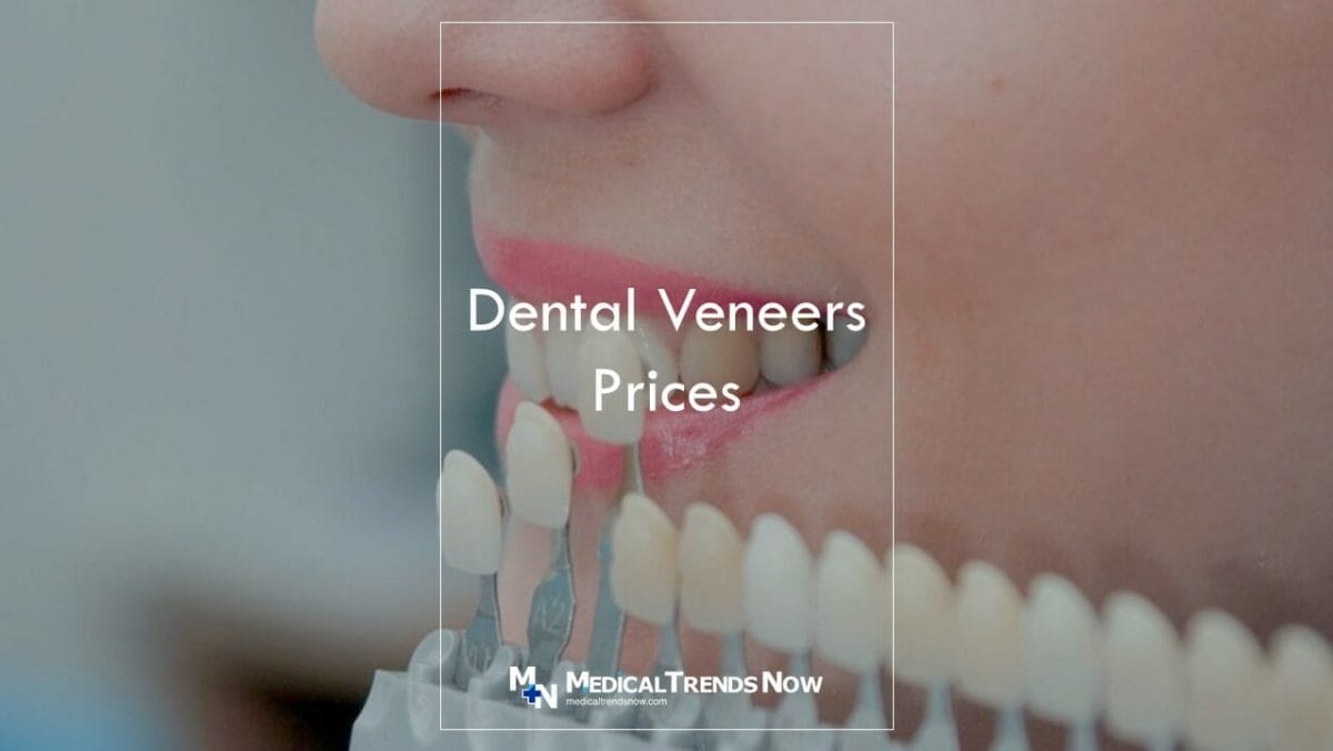 How long do veneers last on teeth?