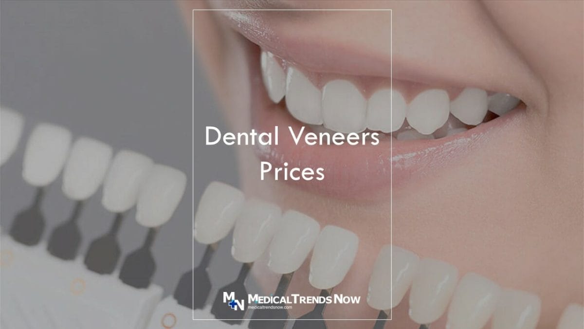Why are veneers so expensive?