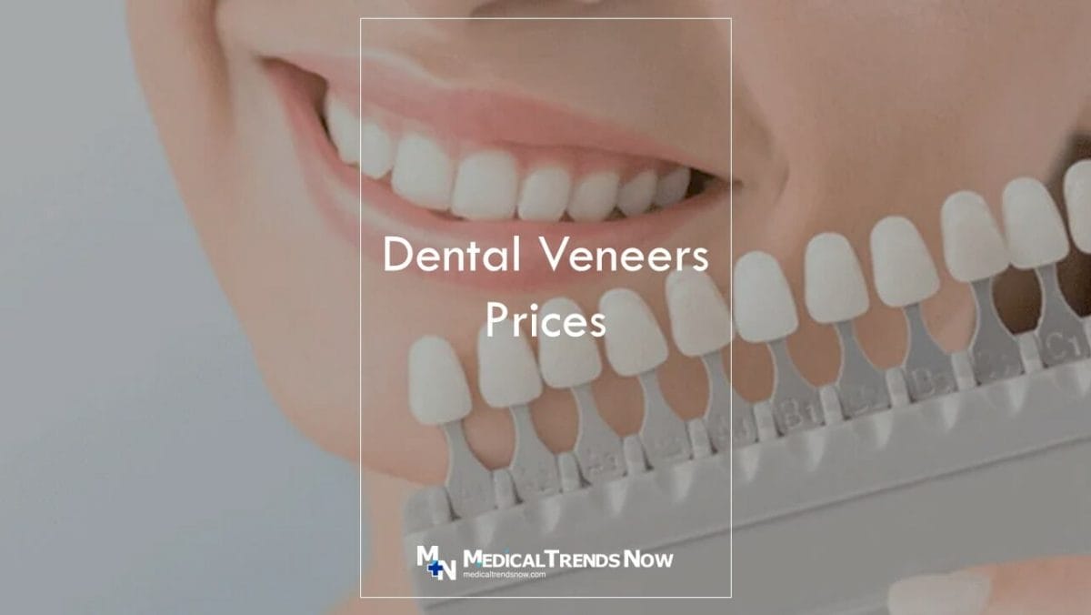How much are porcelain veneers in the Philippines?