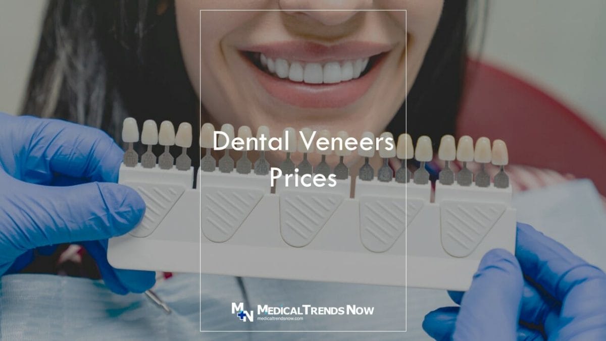 How much does a veneer cost in the Philippines?