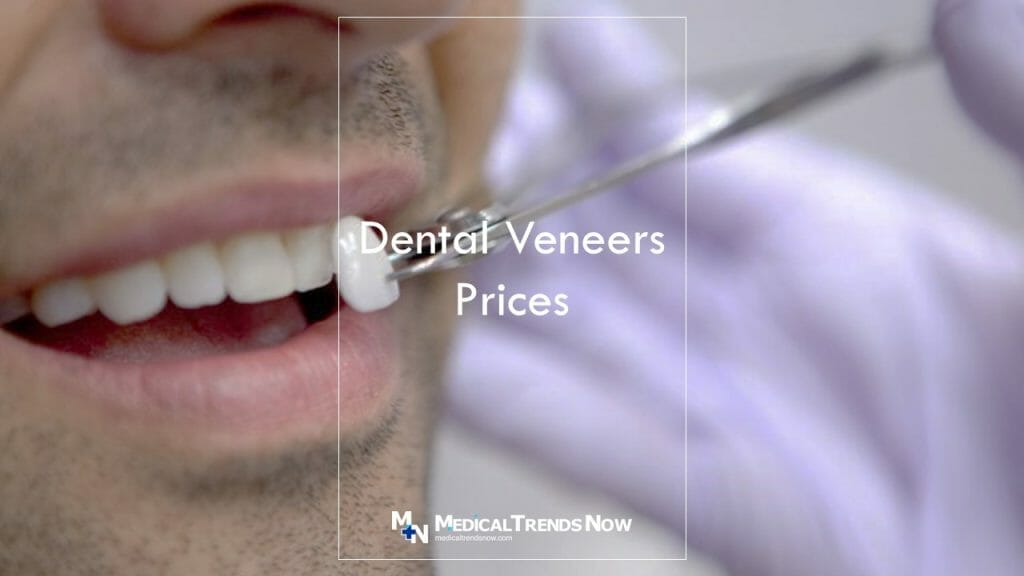 Dental Veneers In The Philippines: The Price Of A Filipino Smile 2023 ...