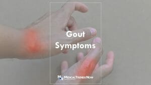 Gout in Hands: Symptoms and Treatment Philipines