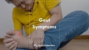 Managing a Gout Flare - Arthritis in Philippines