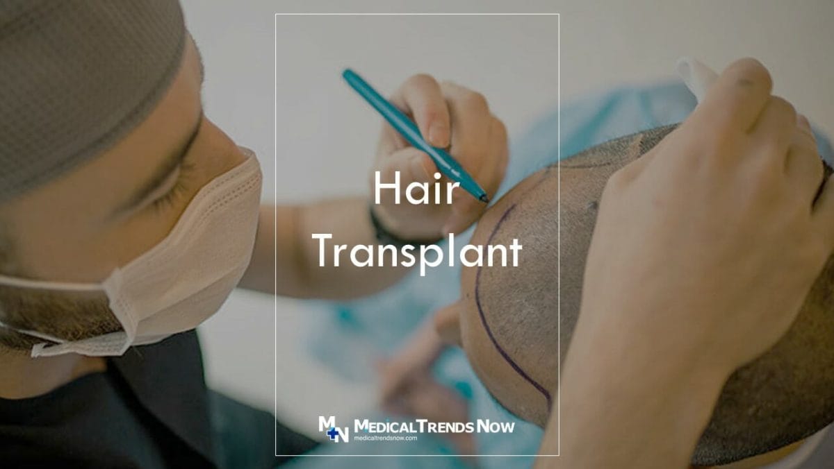 When is it too late to get a hair transplant? It's Never Too Late for Hair Transplant Surgery in the Philippines