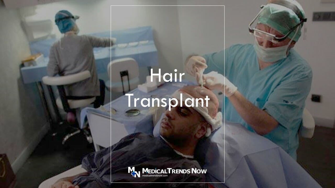 How Much Time Does It Take For Hair To Develop After Hair Transplant?