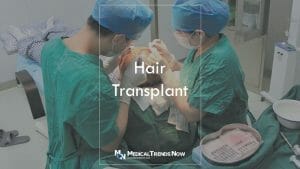 Can I grow my hair long after a hair transplant?