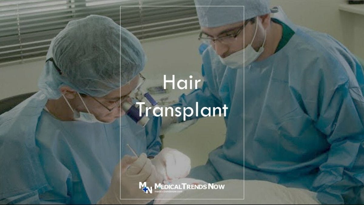 Hair Transplant Procedures: Average Cost, What to Expect, and More