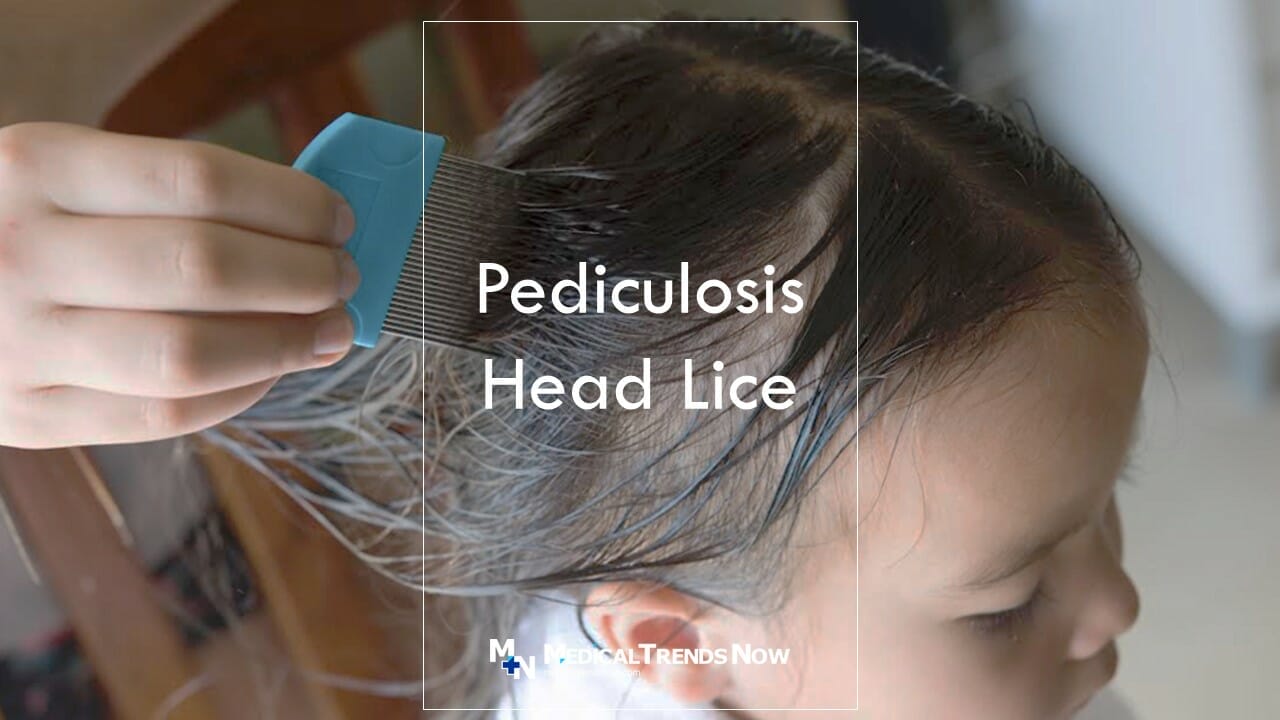 How do you treat a 2 year old with Pediculosis infestation