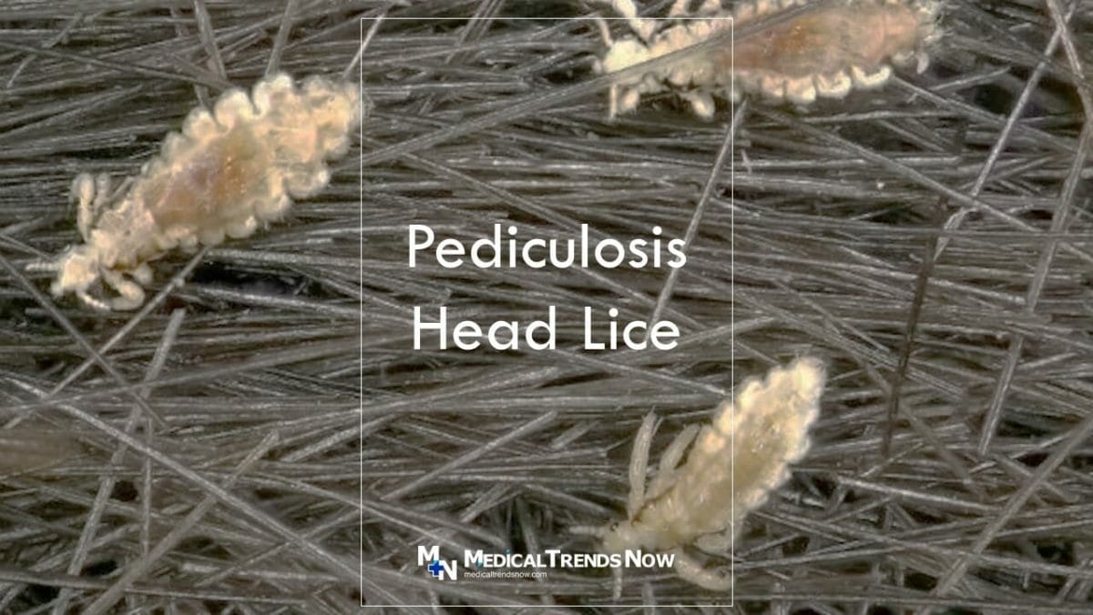 Pediculosis in the Philippines