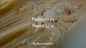 What is pediculosis and how to treat it