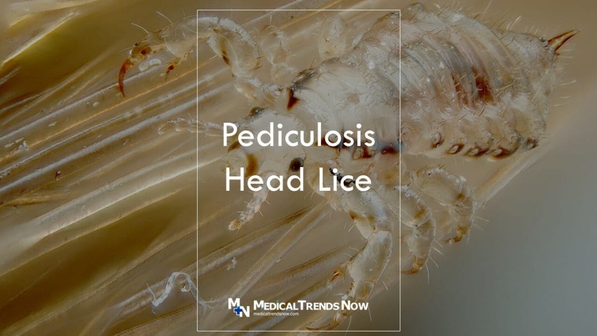 What is pediculosis and how to treat it