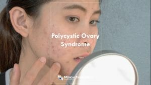 Is PCOS common in Philippines?