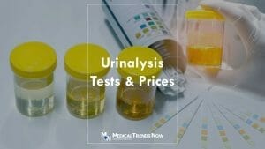 What is the difference between urine test and urinalysis?