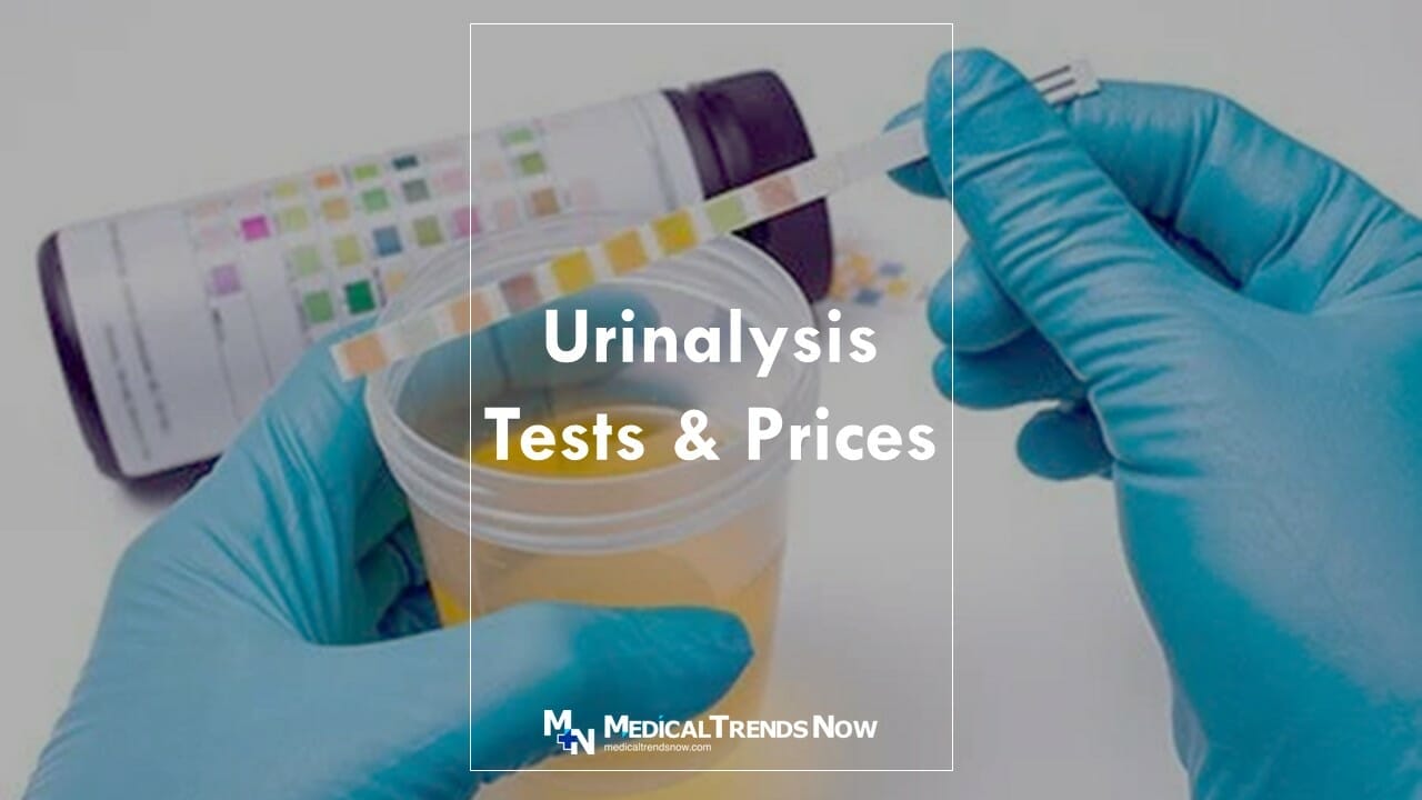 What are 4 types of tests done on urine?