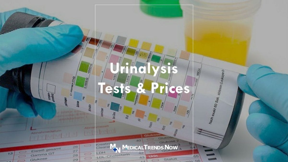 How much is the urinalysis test Philippines?