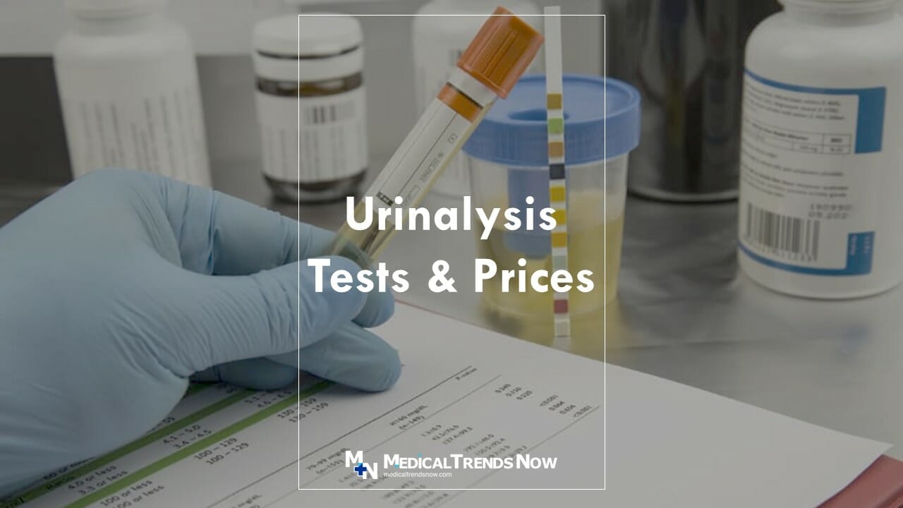Urinalysis Test Price in the Philippines 2023 What It Is For Urinalysis Test Price in the Philippines 2023 What It Is For