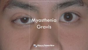 A male Filipino patient with Droopy Eyelids or Eyes That Do Not Move 
