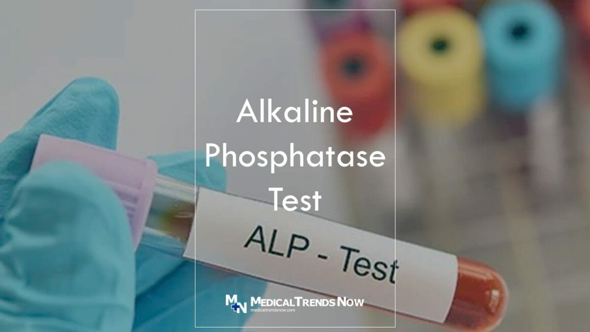 Alkaline Phosphatase Test Low, Normal Range, High Meaning – Medical ...