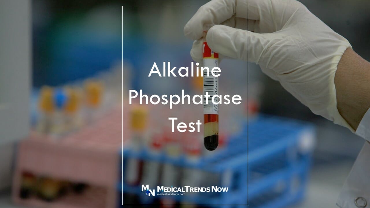 How can I lower my alkaline phosphatase naturally?