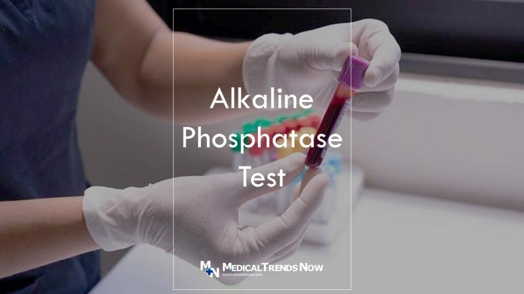 Alkaline Phosphatase Test Low, Normal Range, High Meaning – Medical ...