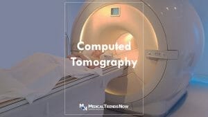 CT Scanner