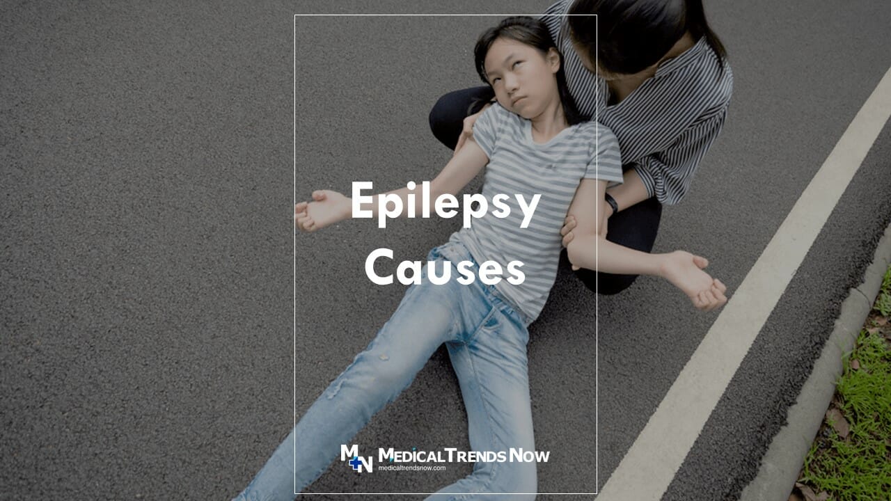What causes an epileptic seizure?