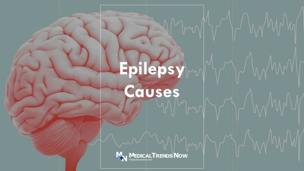 What happens during epilepsy seizure?